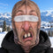 Men Two front teeth